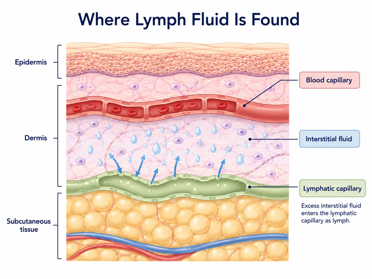 Diagram titled Where Lymph Fluid Is Found, showing the epidermis, dermis and subcutaneous tissue, with excess interstitial fluid entering a lymphatic capillary as lymph.
